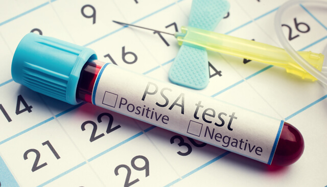 The PSA Test And Screening Prostate Cancer Foundation, 52% OFF